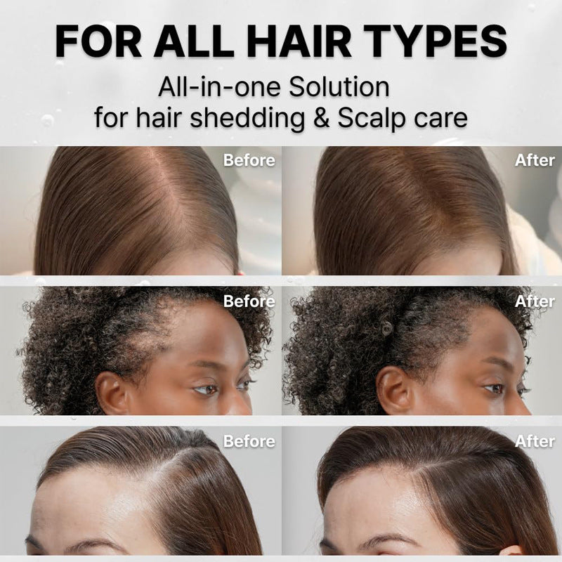 Revive Hair Serum