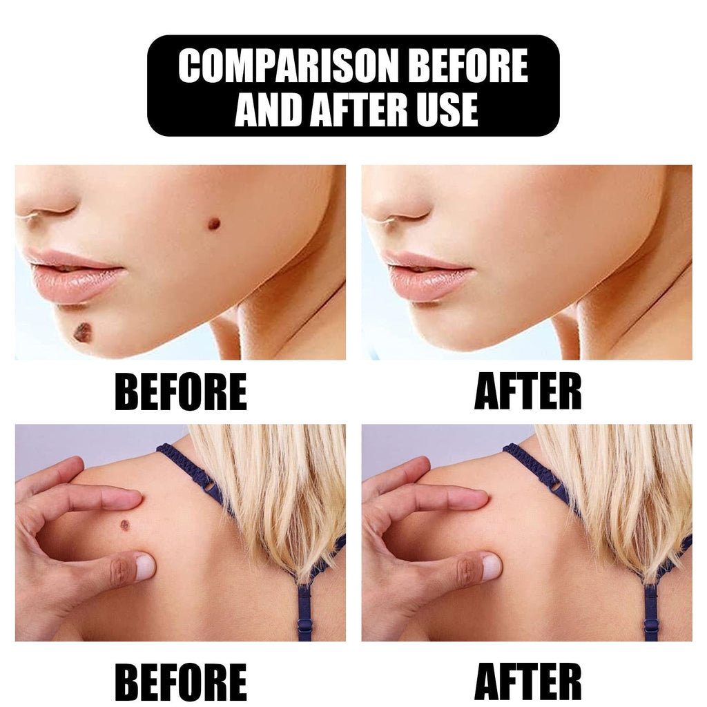 🔥2026 New Arrivals: 50% Off for a Limited Time!🔥Pore Refining & Hydrating Lactobionic Acid Serum