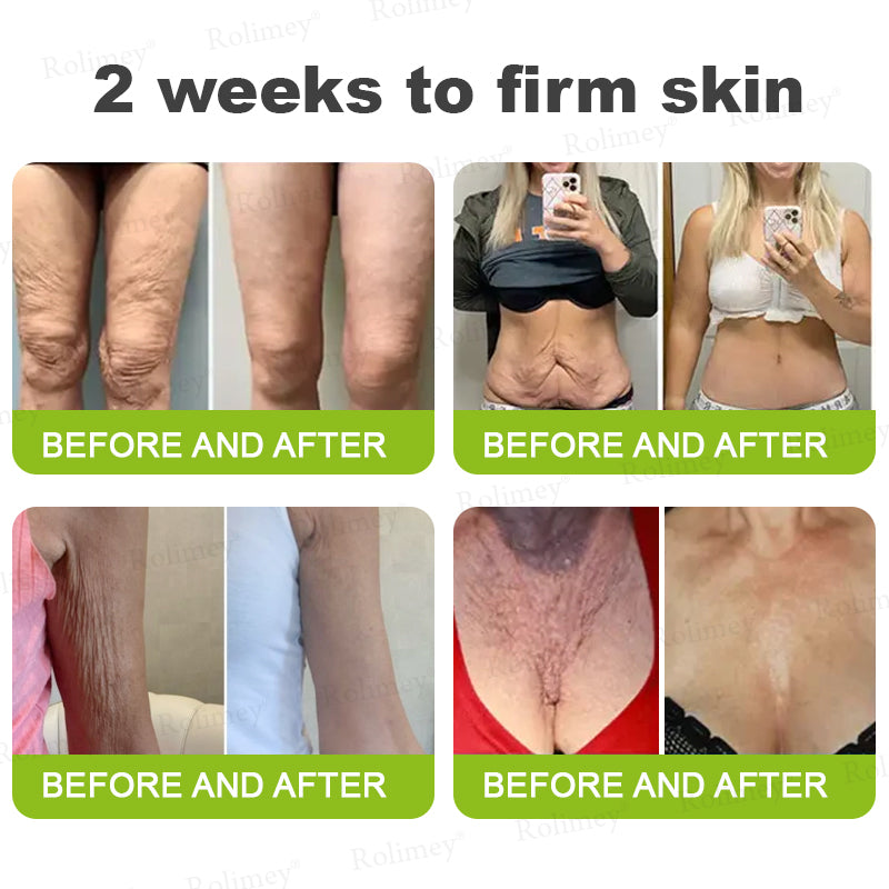 💫👨‍⚕️Made and shipped from the UK 💫Rolimey® Botox & Vita-A Retinol Shot Wrinkle-Lift Tightening cream - Last Day Promotion 70% OFF