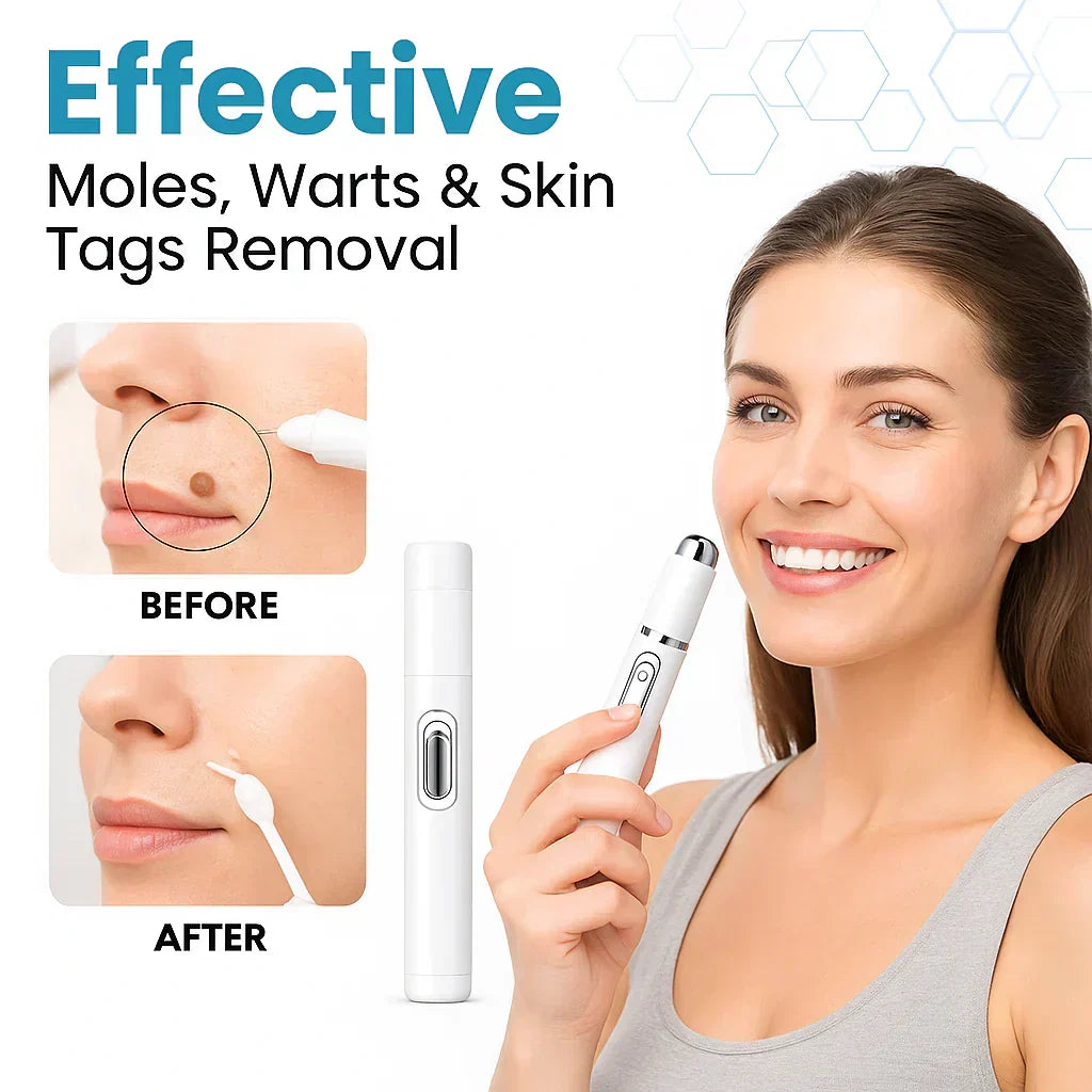 Blue laser pen for stain removal