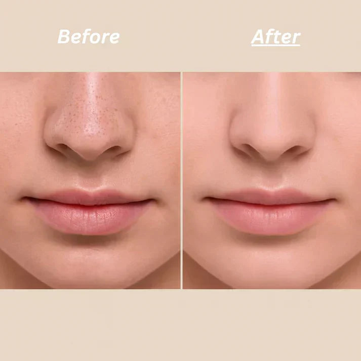 Dr Melaxin Peel Shot Ampoule