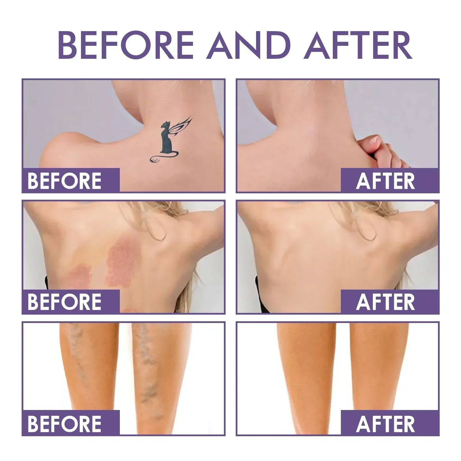 Body Perfector