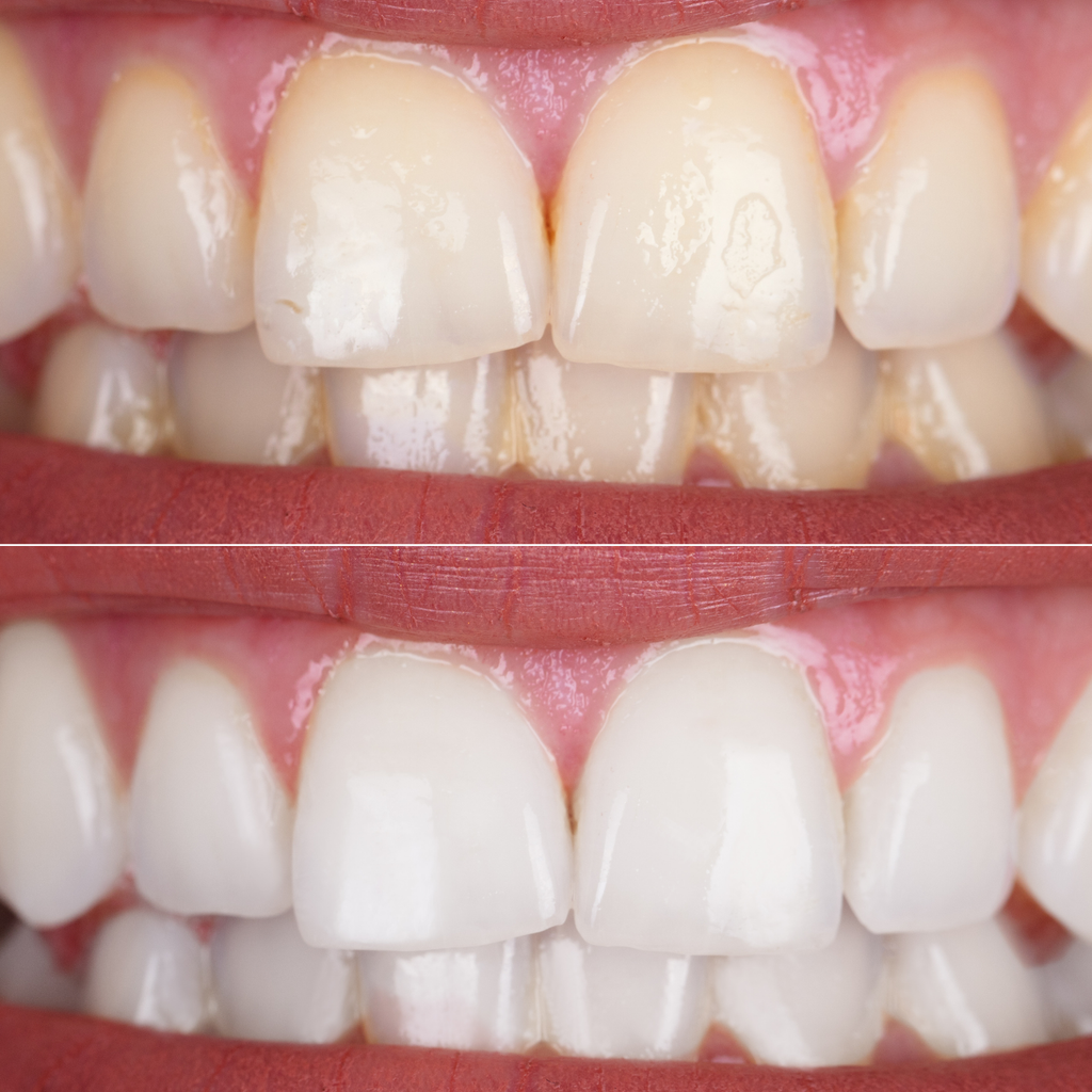 Purple Toothpaste